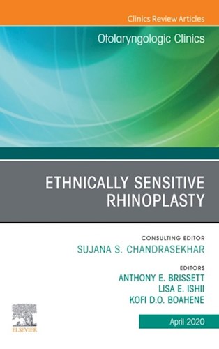  Ethnically Sensitive Rhinoplasty  An Issue Of Otolaryngologic Clinics Of North America  An Issue Of Otolaryngologic Clinics Of North America E-Book