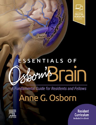  Essentials Of Osborn S Brain