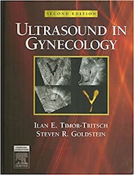 Papel Ultrasound In Gynecology