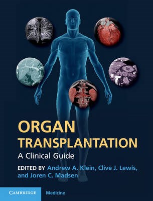 Papel Organ Transplantation: A Clinical Guide
