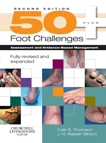  50 Foot Challenges