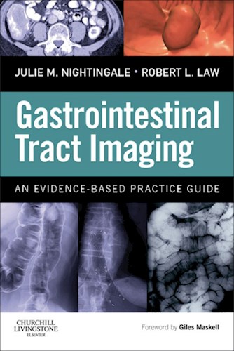 E-book Gastrointestinal Tract Imaging