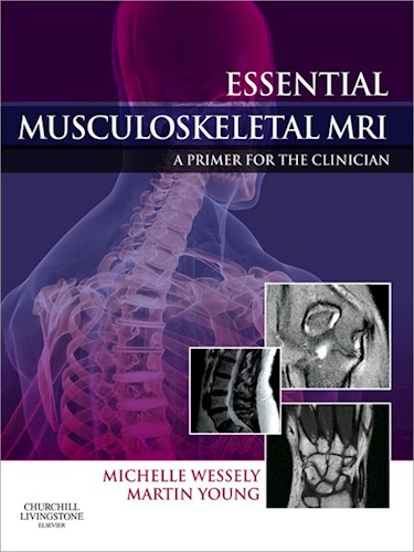 E-book Essential Musculoskeletal MRI