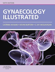 E-book Gynaecology Illustrated