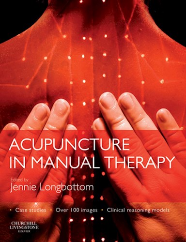 E-book Acupuncture in Manual Therapy