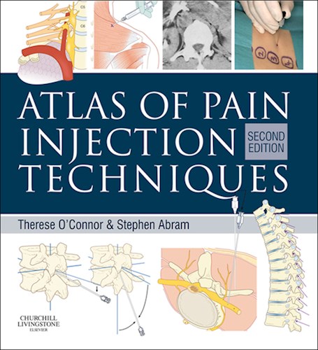 E-book Atlas of Pain Injection Techniques
