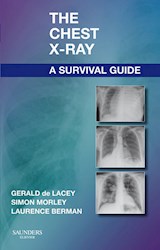 E-book The Chest X-Ray: A Survival Guide