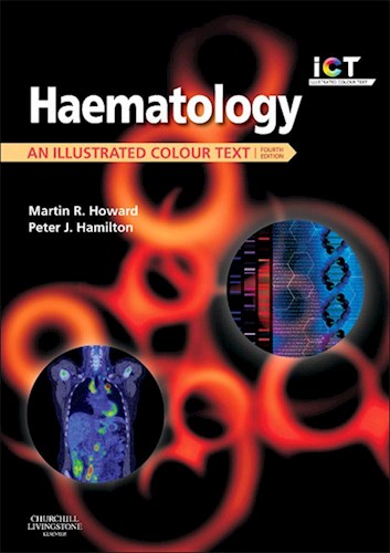 E-book Haematology