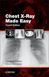 E-book Chest X-Ray Made Easy