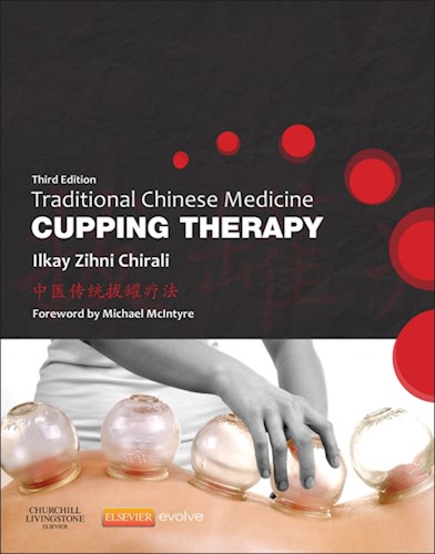  Traditional Chinese Medicine Cupping Therapy