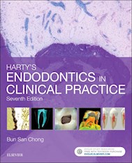 E-book Harty'S Endodontics In Clinical Practice