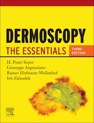 E-book Dermoscopy