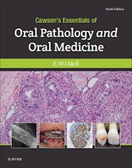 E-book Cawson'S Essentials Of Oral Pathology And Oral Medicine