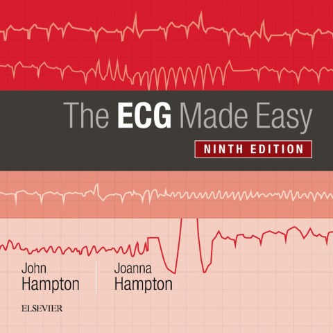 E-book The ECG Made Easy