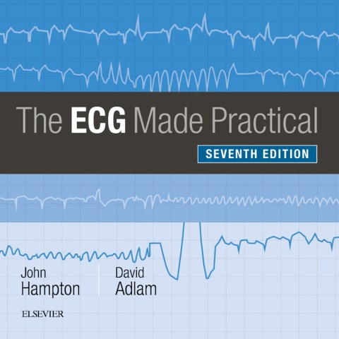 E-book The ECG Made Practical