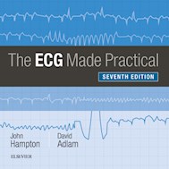 E-book The Ecg Made Practical