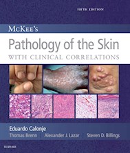 E-book Mckee'S Pathology Of The Skin, 2 Volume Set