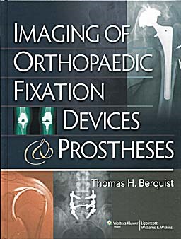 Papel Imaging of Orthopedic Fixation Devices & Prostheses