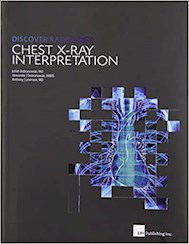 Papel Discover Radiology: Chest X-Ray Interpretation