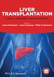 Papel Liver Transplantation: Clinical Assessment And Management