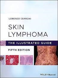 Papel Skin Lymphoma. The Illustrated Guide