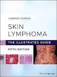 Papel Skin Lymphoma. The Illustrated Guide