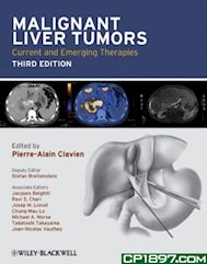 Papel Malignant Liver Tumors Ed.3