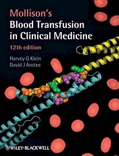 Papel Mollison's blood transfusion in clinical medicine
