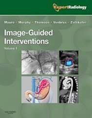 Papel Image-Guided Interventions (2 Vol Set)