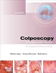 Colposcopy Principles And Practice An Integrated Text And Atlas