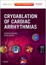 Papel Cryoablation Of Cardiac Arrhythmias
