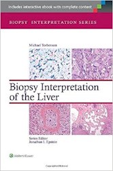 Papel Biopsy Interpretation Of The Liver