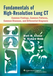 Papel Fundamentals Of High-Resolution Lung Ct: Common Findings, Common Patterns, Common Diseases, And Difs