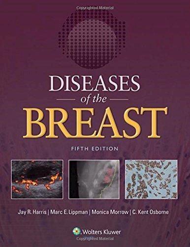 Papel Diseases of the breast Ed.5