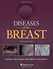 Papel Diseases Of The Breast Ed.5