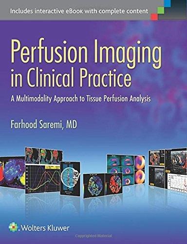 Papel Perfusion Imaging in Clinical Practice