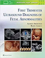 Papel First Trimester Ultrasound Of Fetal Abnormalities