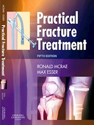 E-book Practical Fracture Treatment