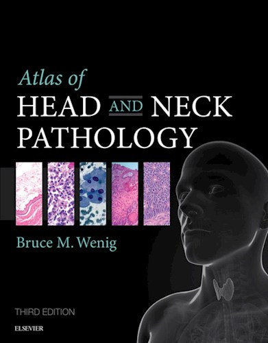 E-book Atlas of Head and Neck Pathology