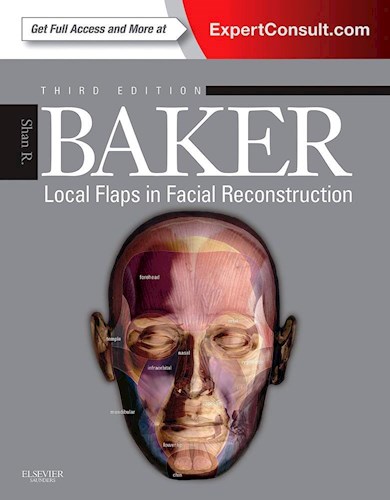 Papel Local Flaps in Facial Reconstruction Ed.3