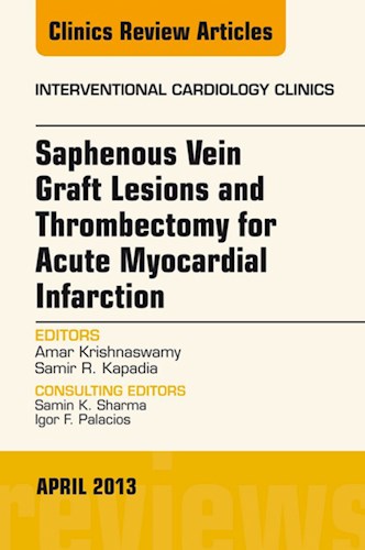 E-book Saphenous Vein Graft Lesions and Thrombectomy for Acute Myocardial Infarction, An Issue of Interventional Cardiology Clinics