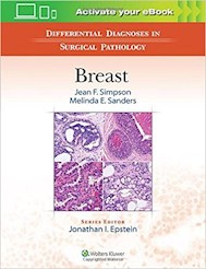 Papel Differential Diagnoses In Surgical Pathology: Breast