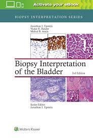 Papel Biopsy Interpretation of the Bladder