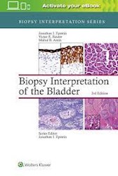 Papel Biopsy Interpretation Of The Bladder