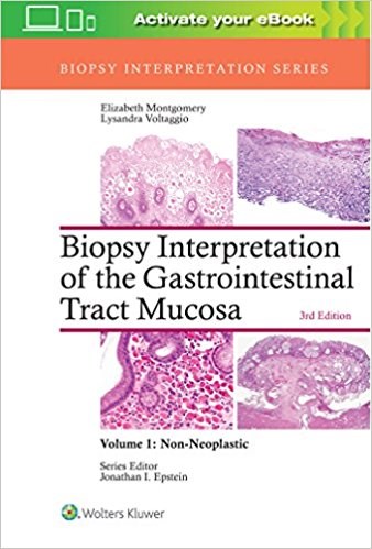 Papel Biopsy Interpretation of the Gastrointestinal Tract Mucosa: Non-Neoplastic Ed.3