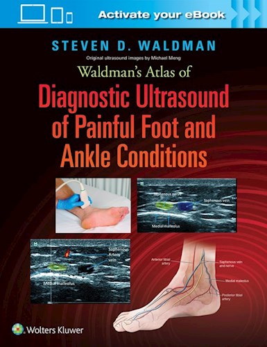 Papel Waldman's Atlas of Diagnostic Ultrasound of Painful Foot and Ankle Conditions