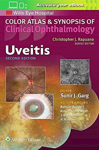 Papel Uveitis. Color Atlas and Synopsis of Clinical Ophthalmology Ed.2