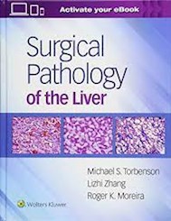 Papel Surgical Pathology Of The Liver