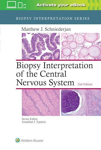 Papel+Digital Biopsy Interpretation of the Central Nervous System Ed.2