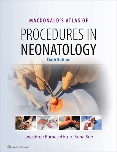  Macdonald S Atlas Of Procedures In Neonatology